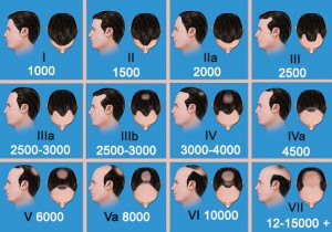 Exoderm Artificial Hair scale